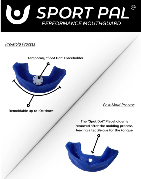 Sport Pal Mouthguard 